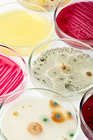 Petri dish